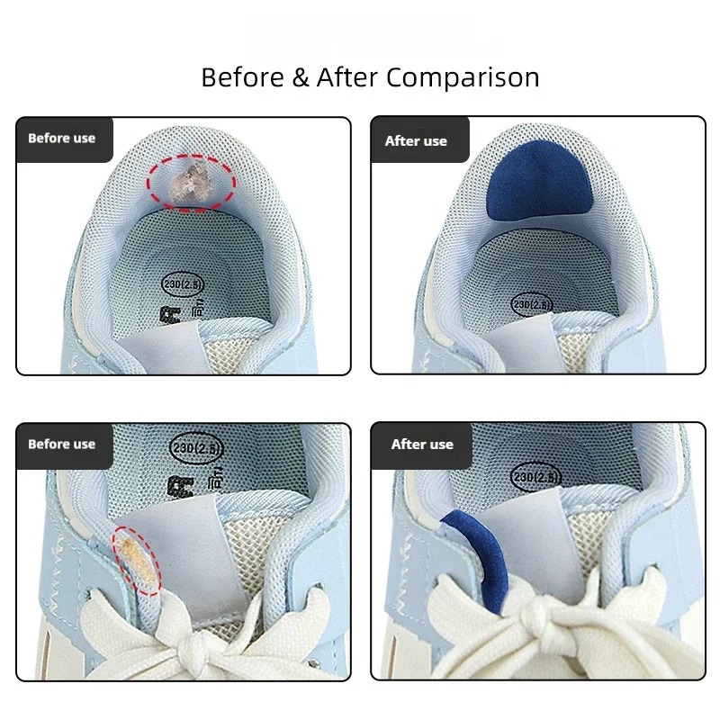6 قطع من ملصقات إصلاح الأحذية  - مراجعة Sneaker Care Service وسعره